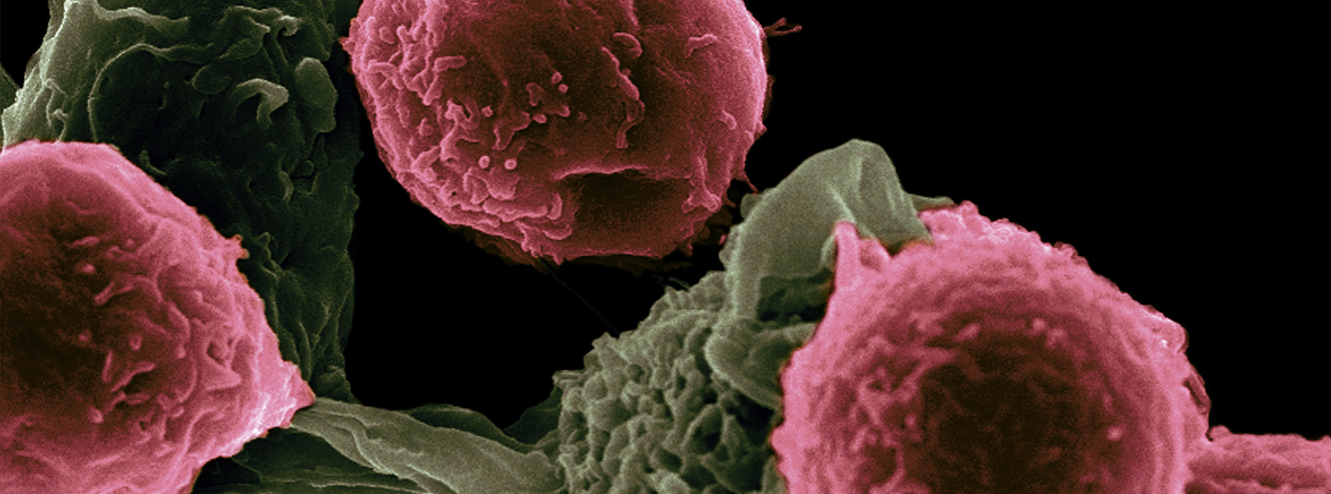 cancer-treatment
